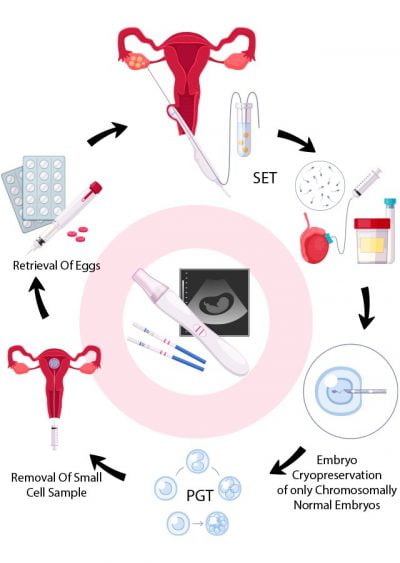 ivf_detail