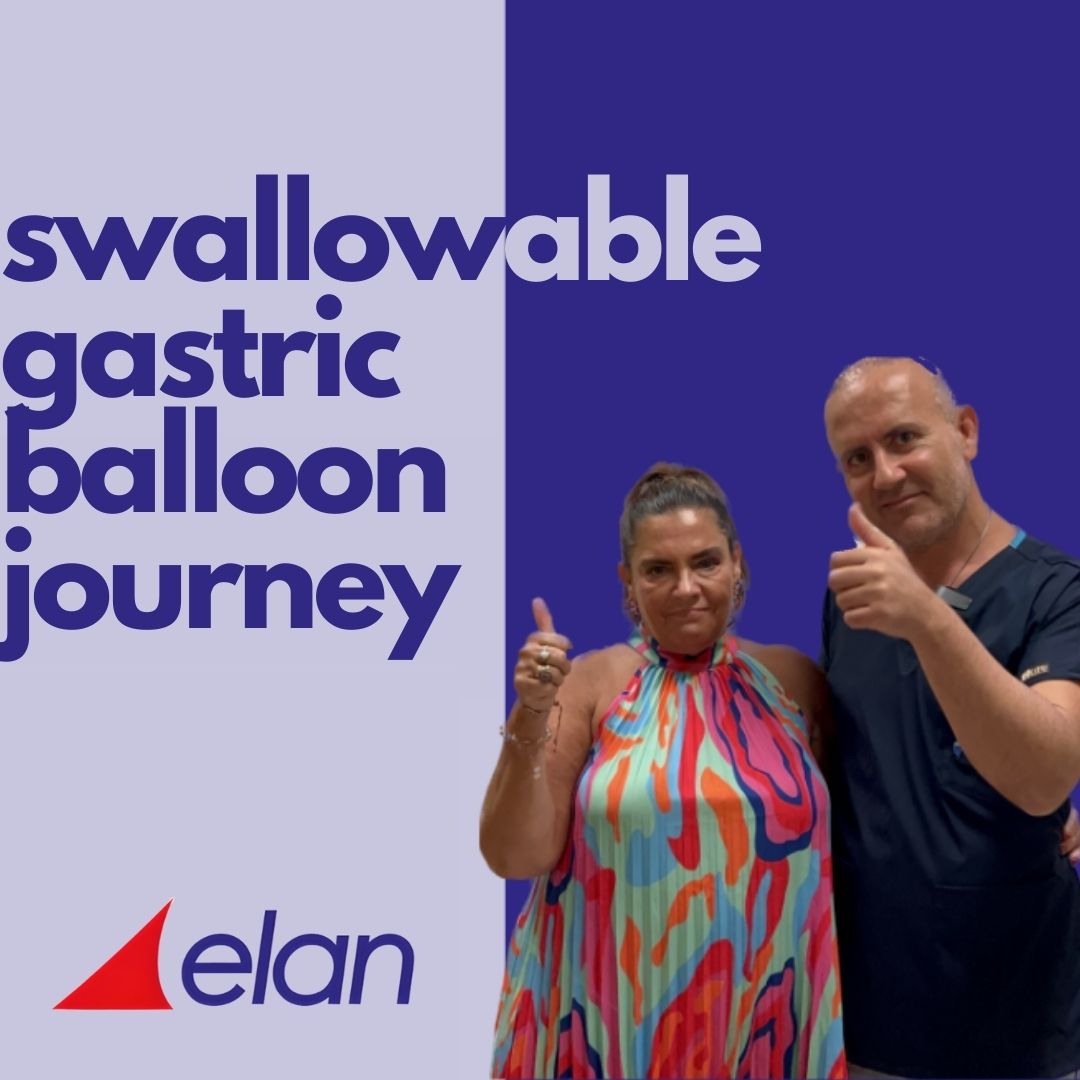 sonnswallowable gastric balloon