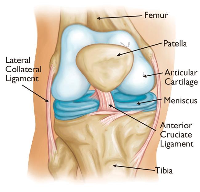 Knee Replacement